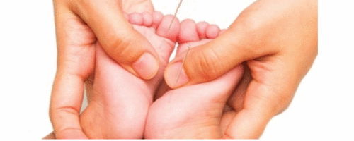 Conheça os Benefícios da Acupuntura em Bebês