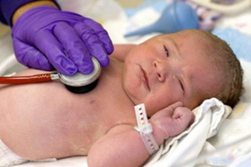 Teste de Apgar e a importância do pediatra neonatologista